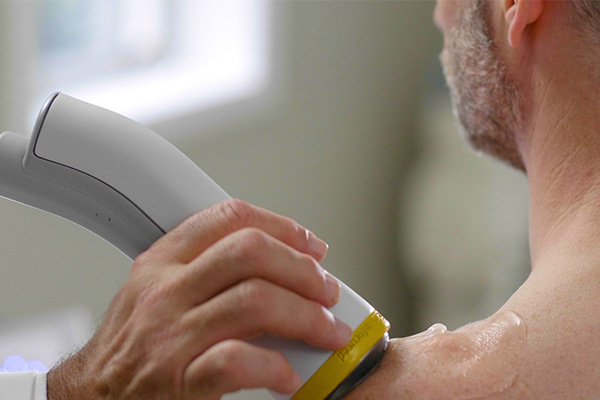 How Does SoftWave Therapy Treat Frozen Shoulder?