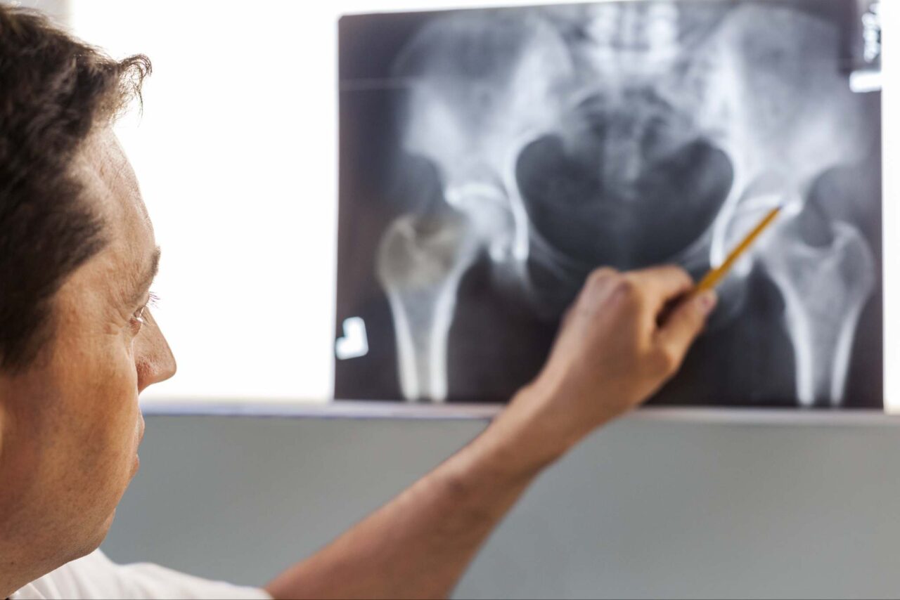 Injections and Surgical Options for Severe Hip and Leg Pain